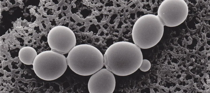 Saccharomyces Cerevisae