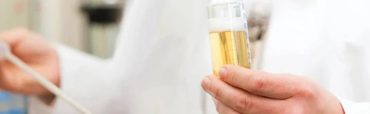 hongos para conservar cerveza artesanal